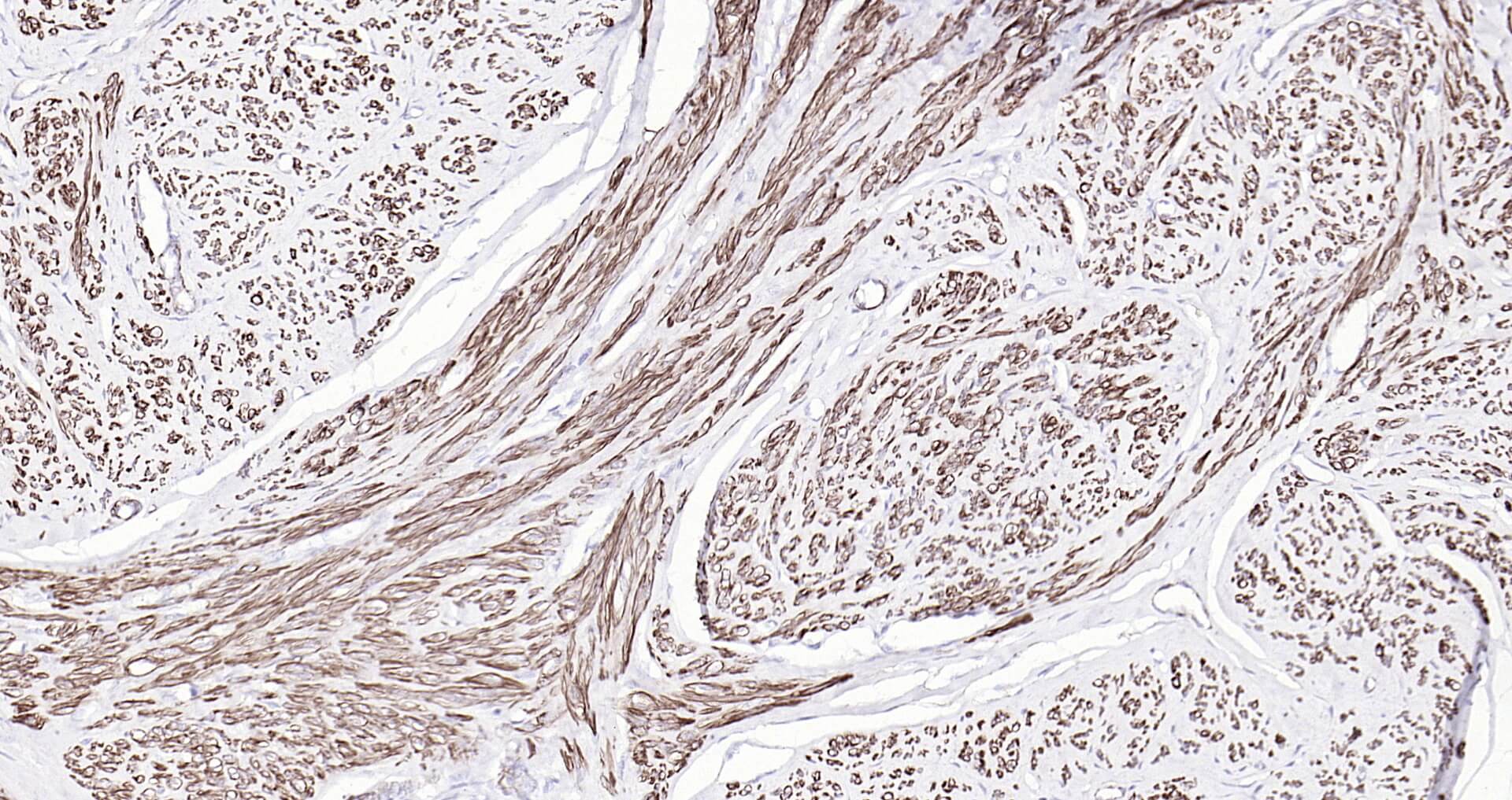 肌动蛋白α/α-SMA/α Actin单克隆即用型免疫组化试剂盒-IHC0114